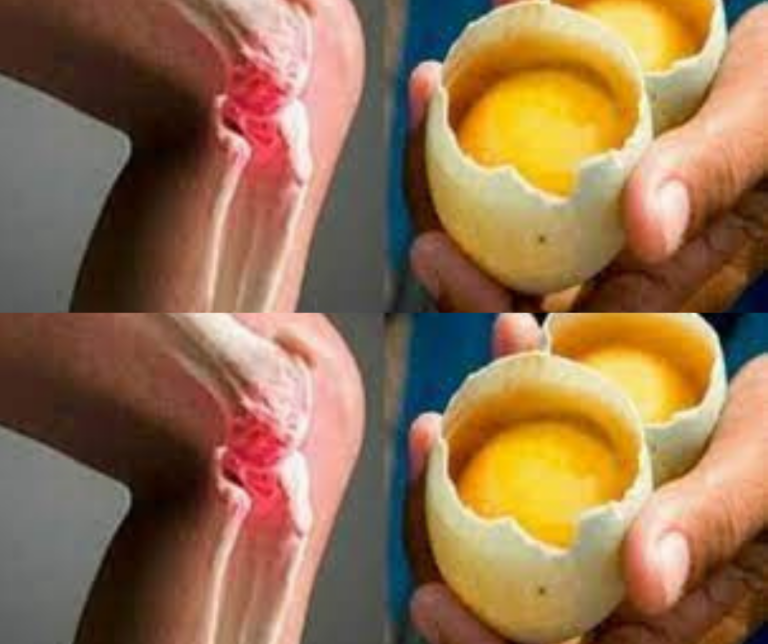 How a simple egg relieved pain in my mother’s knees and bones.