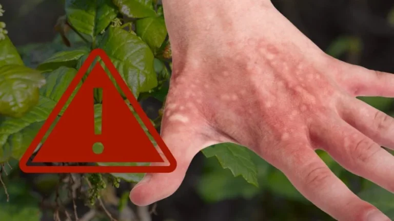BEWARE OF THIS PLANT THAT MANY GROW: IT IS TOXIC | YOU BURN INSTANTLY