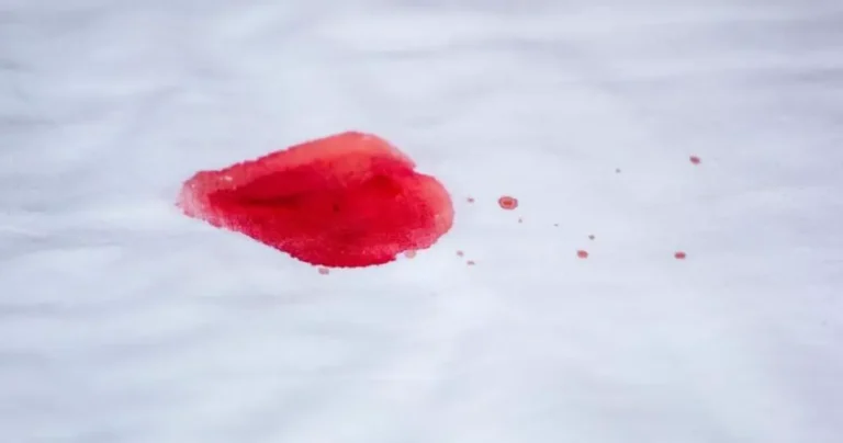 Blood stains on clothes? here is grandma’s trick to eliminate them