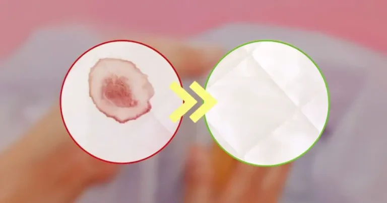 How to remove dried blood stains on fabrics without bleach