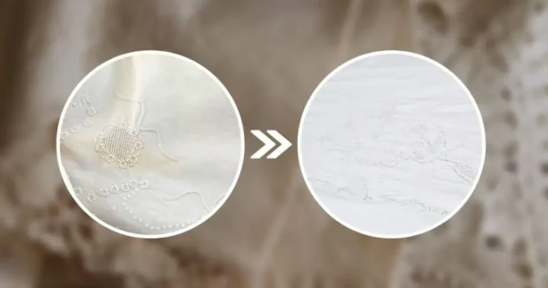 Grandma’s yellowish kit, make it immaculate white again with this method