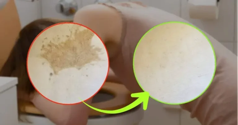 Vomit stains on the carpet, the home method to remove them