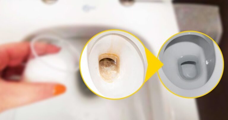 Yellowish toilet bottom, run to the kitchen to get rid of it immediately: just one drop is enough