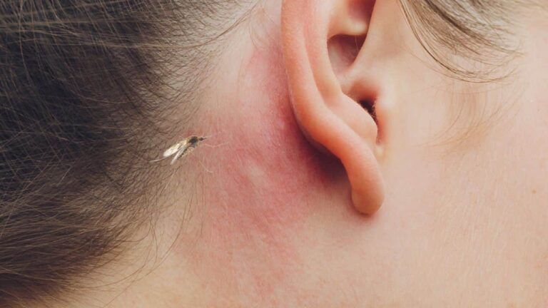 Why do mosquitoes come close to your ears? The reason would be precisely this